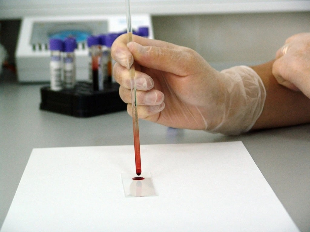 Faire un bilan de santé sans attendre les symptômes